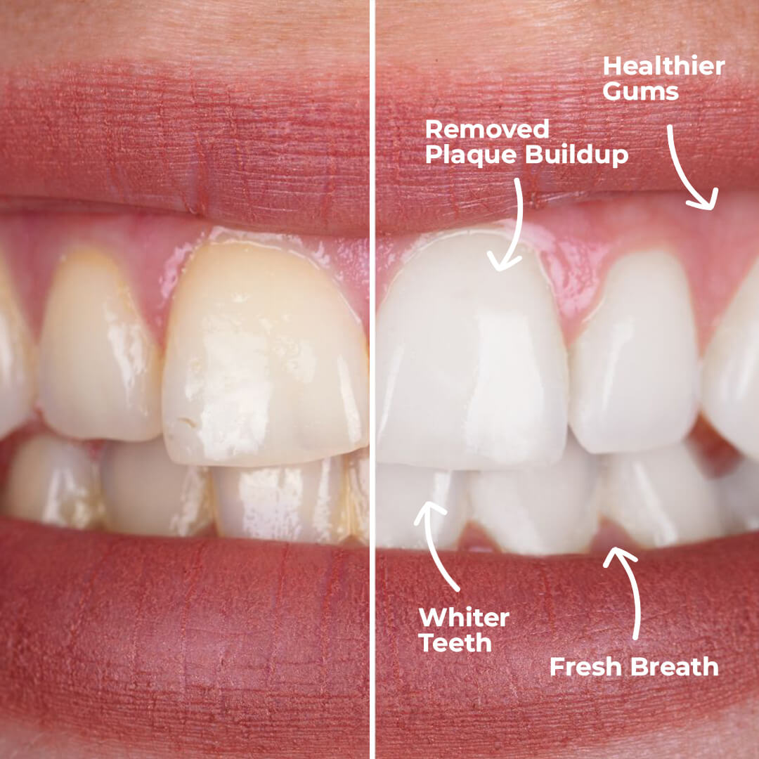 PuurSmile Water Flosser