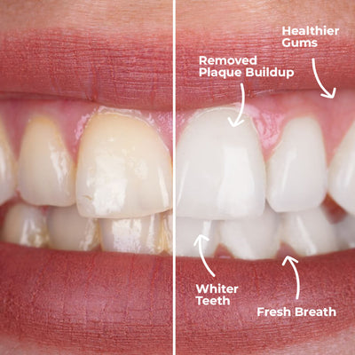 PuurSmile Water Flosser