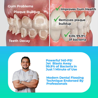 PuurSmile Water Flosser