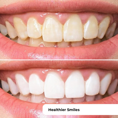 PUURSMILE WATER FLOSSER - 50% OFF HALLOWEEN SALE