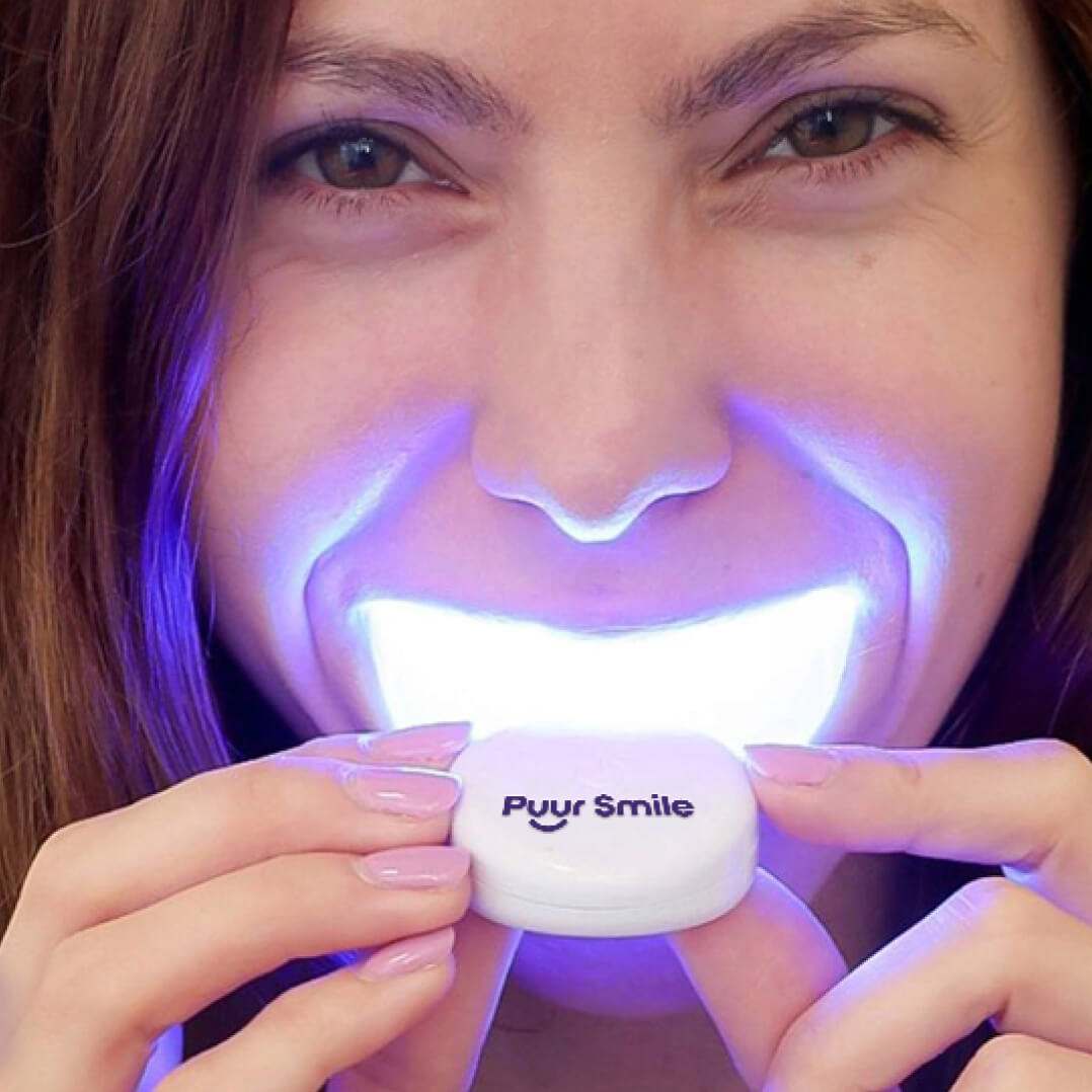 Teeth Whitening Kit (Preview Only)