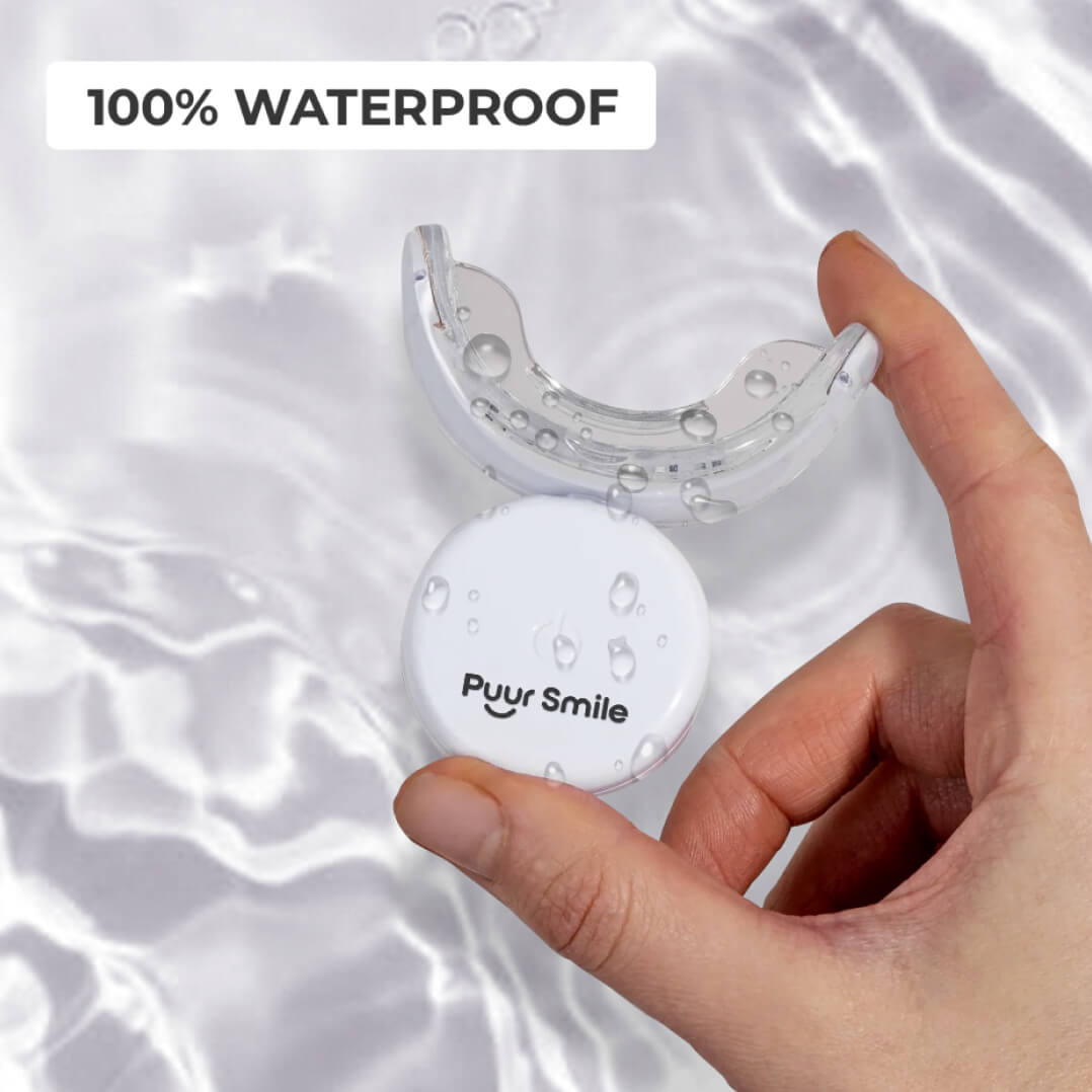 Teeth Whitening Kit (Preview Only)