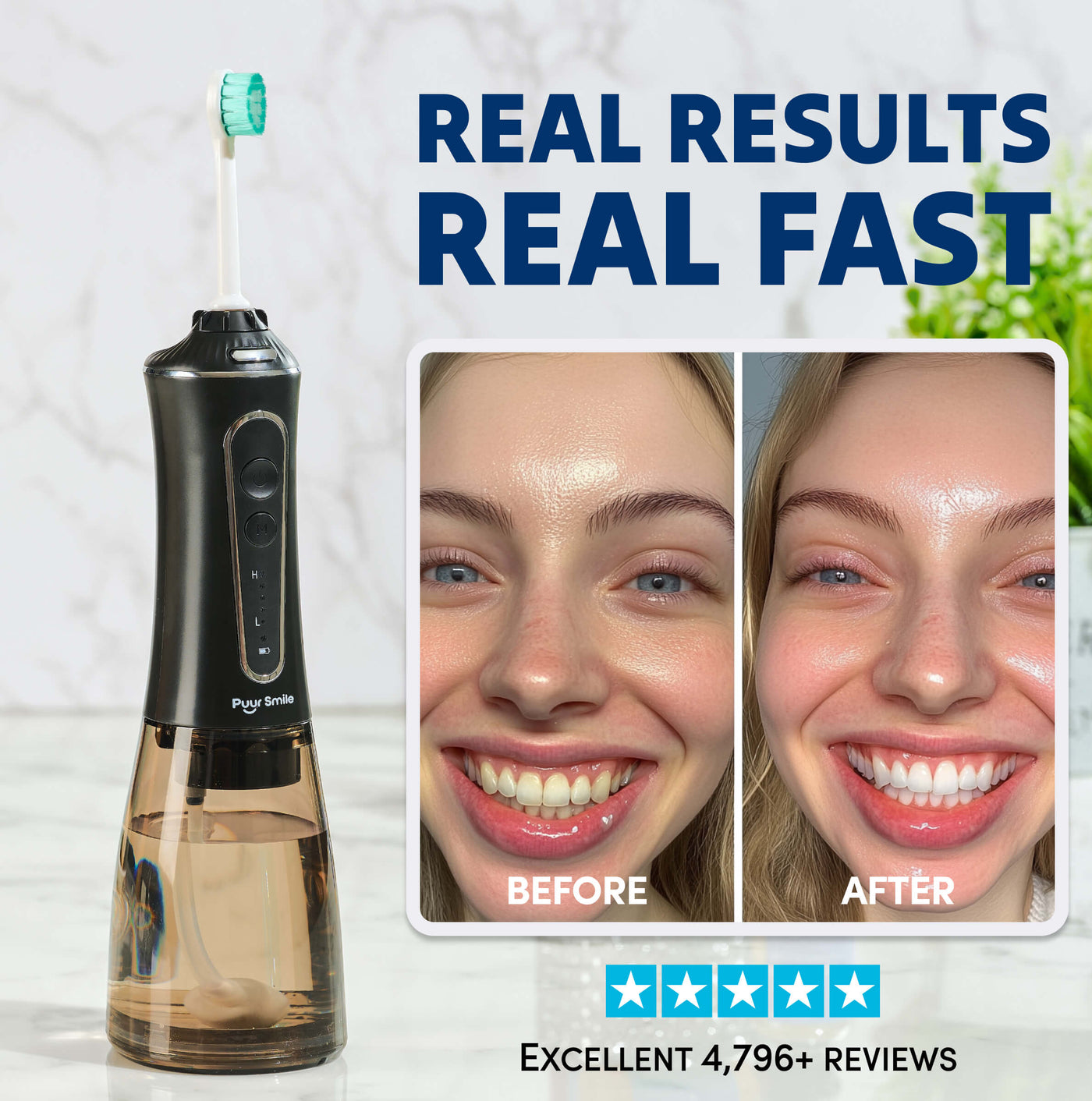 PuurSmile® Electric Water Flosser